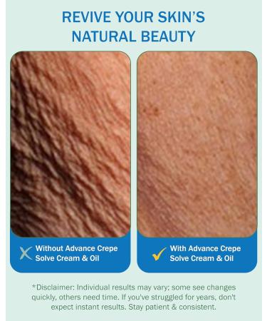 e70 Advanced Oil and Cream Crepe Skin (4 Pack) - Buy Online on GoSupps.com