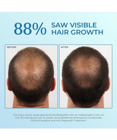 Bosley Men's Hair Re-growth Treatment | 5% Minoxidil Topical Solution - Buy Online on GoSupps.com