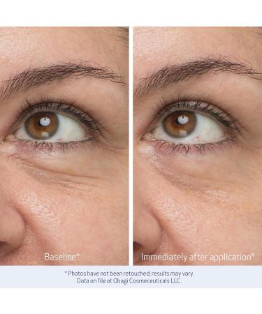 Obagi Medical Ultimate Hydration Duo with Daily Hydro Drops Facial Serum & Daily Hydro Drops Eye Gel Cream Deeply Hydrate & Reduce the Appearance of Dark Circles & Puffiness - Buy Online on GoSupps.com