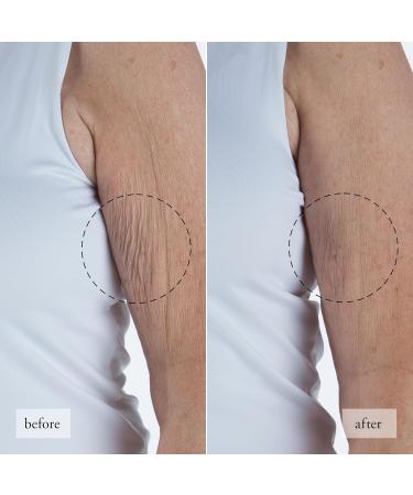 Buy Philosophy Ultimate Miracle Worker Resurfacing Body Serum - Retinol Hyaluronic Acid & Peptides - 6.5 fl oz | International Shipping Available - Buy Online on GoSupps.com