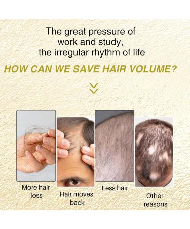 Onion Hair Strengthening Oil Spray - Onion Oil for Hair Growth Moisturizes Scalp & Hair | Nourishing & Volumizing | Eliminates Split Ends Hair Regrowth for Stronger For All Hair Types - Buy Online on GoSupps.com
