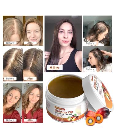 Pure Batana Oil for Hair - Cold Pressed 120g | Stimulate Growth & Moisturize Dry Hair - Buy Online on GoSupps.com