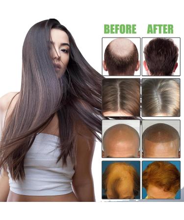Essential Oil for Hair Density & Growth - 30ml Aibyks Natural Wild Hair Growth Oil - Buy Online on GoSupps.com