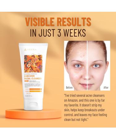 ABERA Turmeric Face Wash for Acne-Prone & Sensitive Skin 4-in-1 Curcumin Cleanser with Niacinamide BHA & Centella Gentle pH Balanced Non-Comedogenic Sulfate Free Facial Cleanser (3 BOXES) C. 3 Box - Buy Online on GoSupps.com