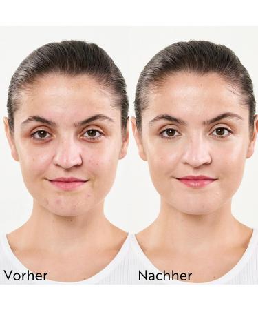  M. Asam M. Asam CLEAR SKIN Better Skin Fruit Enzyme Exfoliating (50ml) - AHA Peeling with Enzymes Gentle Fruit Acids Exfoliator for All Skin Types Exfoliating Skin Care for Clear Skin  - Buy Online on GoSupps.com