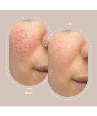 Argan Stem Cell Serum - Hydrating Age-Defying Treatment with Hyaluronic Acid and Argan Oil - 30 mL - Buy Online on GoSupps.com