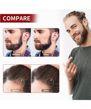 IOPYKKOA Beard Roller 0.5mm for Beard Growth | Microneedling Derma Roller | Enhance Facial Hair Growth | International Shipping Available - Buy Online on GoSupps.com