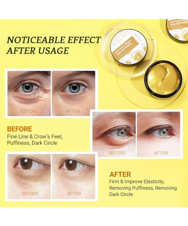 LIYALAN Gold Under Eye Patches - Dark Circle & Puffiness Treatment - Buy Online on GoSupps.com