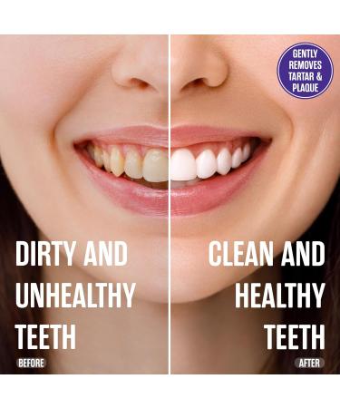 SprinJene Natural Relief pour vos dents sensibles dentifrice sans fluorure pour dents sensibles | Dentifrice naturel pour prot ger contre les caries | Lot de 4 - Buy Online on GoSupps.com