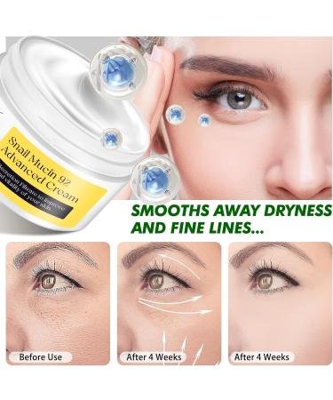  Generisch 92% Snail Mucin Repair Cream - Skin Care - Anti-Aging Moisturizing Cream - Daily Facial Repair - Deep Hydration - Nourishes the Skin - Mucin - Repair Cream - Buy Online on GoSupps.com