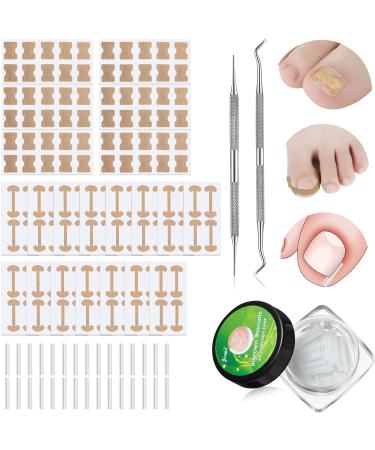 Lanties 152 Pieces Ingrown Toenail Corrector Treatment Tool Sets  Include Curved Toenail Brace Nail Toenail Corrector Sticker  Ingrown Toenail Corrector Strips  Toenail File and Lifter