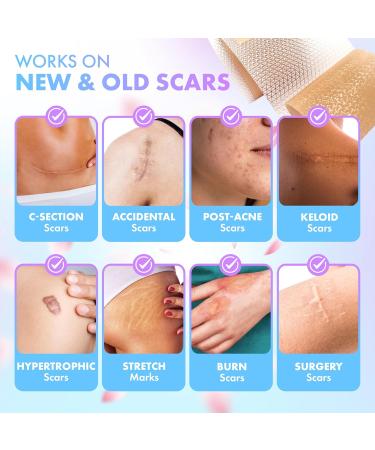 Silicone Scar Tape for Effective Scar Removal | Medical Grade 130x1.5 Inch Roll for Surgical Acne & Keloid Scars - Buy Online on GoSupps.com