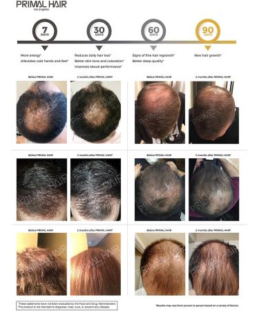 PRIMAL HAIR Growth Supplement | Clinically Proven Hair Loss Treatment | Supports Natural Growth & Reduces Hair Thinning | 30-Day Supply 120 Count - Buy Online on GoSupps.com