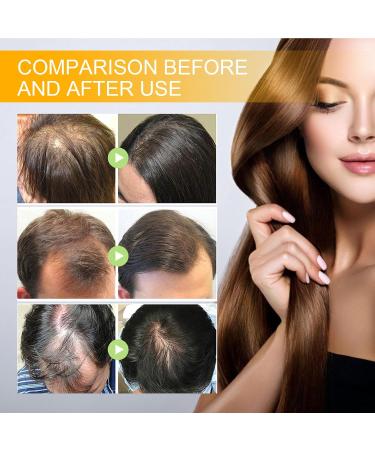 Luxury Biotin Hair Growth Serum - Premium 3pcs Set for Enhanced Hair Growth - Buy Online on GoSupps.com
