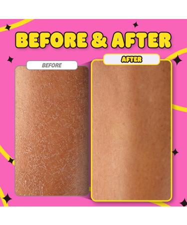 BACK TO BABY Exfoliating Glove | Korean 2-in-1 Loofah Body Scrubber | Best for All Skin Types Keratosis Pilaris & Dry Skin Removal - Buy Online on GoSupps.com