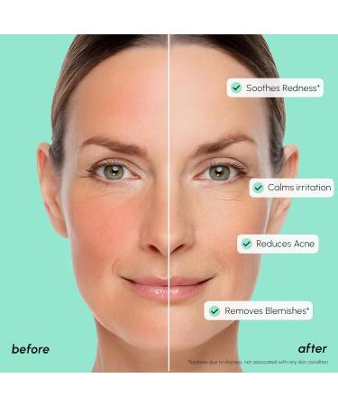 MAREE 10% Azelaic Acid Face Serum - Redness Soothing Hydrating Serum with Niacinamide Centella Asiatica & Hyaluronic Acid - Relief Serums for Face & Body - Azalecic Acid Skin Facial - Acido Azelaico 1 Fl Oz (Pack of 1) Aze  - Buy Online on GoSupps.com