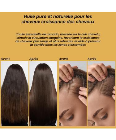 Rosemary Oil for Hair Stimulates Growth and Prevents Hair Loss Rosemary Oil Nourishes Dry Scalp Thickens Eyebrows and Eyelashes Eliminates Itching Made in Italy - Buy Online on GoSupps.com