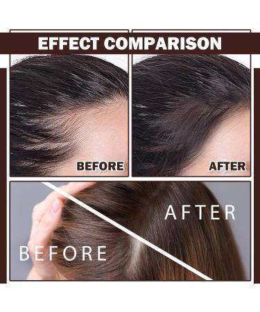 Root Cover Up Hair Topper Powder | Conceal Hair Loss & Thinning Hair - Long-Lasting Natural Color | Ideal for Bald Spots Hairline Shadows & Beard Lines - Black - Buy Online on GoSupps.com