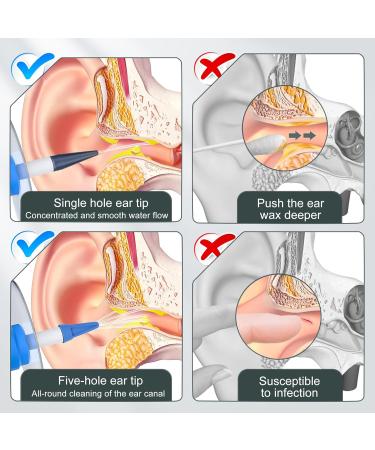 Ear Wax Removal Tool Safe & Effective Flushing System for Adults & Kids | Ear Cleaner Kit for Built-Up Wax - Buy Online on GoSupps.com