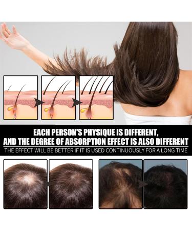 Nourishing Hair Strengthening Oil Hair Repair Oil Hair Strengthening Oil Hair Essential Oil Hair Growth Oil Nourishing Hydrating Hair Growth Vitamin B7 Hair Growth Oil for Men Hairless 30ML - Buy Online on GoSupps.com