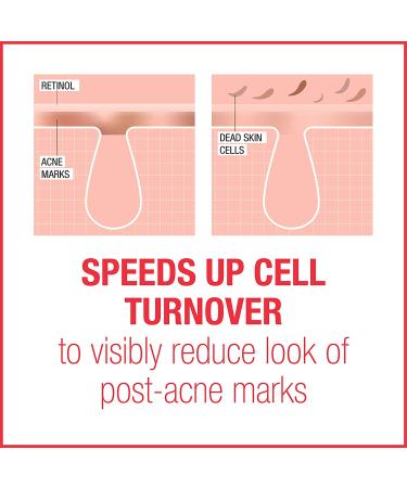 Neutrogena Stubborn Marks PM Treatment - 1 fl oz (29 ml) for Clearer Skin - Buy Online on GoSupps.com