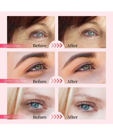 Beauty7 Brightening Eye Gel Patches - Hydrogel Eye Mask with Niacinamide, Squalane, and Sodium Hyaluronate - 20 Pairs for Daily Use - 50 Fl Oz - Buy Online on GoSupps.com