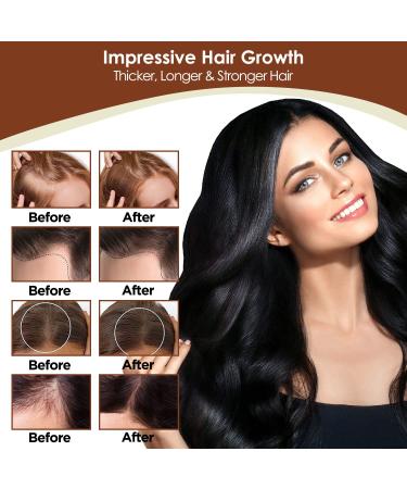 Hair Growth Serum & Oil for Thicker, Healthier Hair | Biotin, Castor Oil, Rosemary | Hair Loss Treatment - Buy Online on GoSupps.com