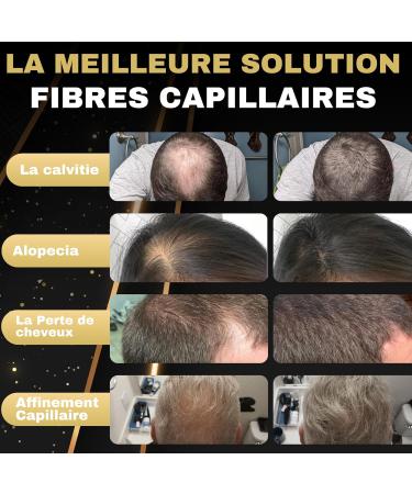 Salvathor Duran Hair Densifying Powder 2x25g (50g Total) - Hair Powder - Hair Fiber 50 g - Hair Densifying Powder - Anti Baldness Powder - Buy Online on GoSupps.com