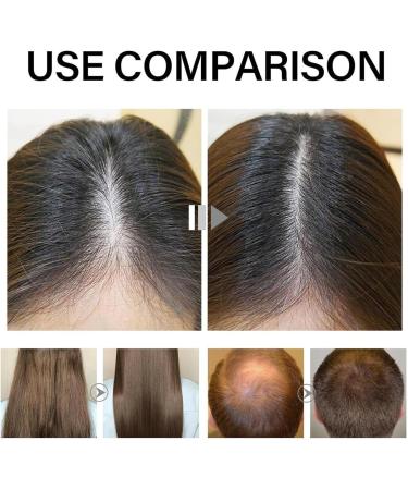  G n rique Scalp Oil for Hair Growth Hair and Scalp Gel | Hair Growth Oil 60ml Scalp Gel to Strengthen Hair - Gentle Thickening Gel for - Buy Online on GoSupps.com