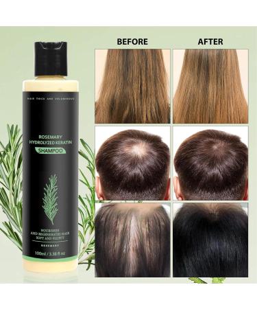 Jingmiger Shampoo For Women100ml Moisturizing Hair Care Products AntiDandruff Volume Moisturizing Shampoo for Damaged Dry Oily Fine Curly Hair Women and Men Daily Use - Buy Online on GoSupps.com