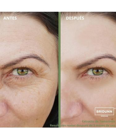 Anti-Wrinkle Face Cream | Natural Ingredients for Tightening & Regeneration | Fast International Shipping - Buy Online on GoSupps.com