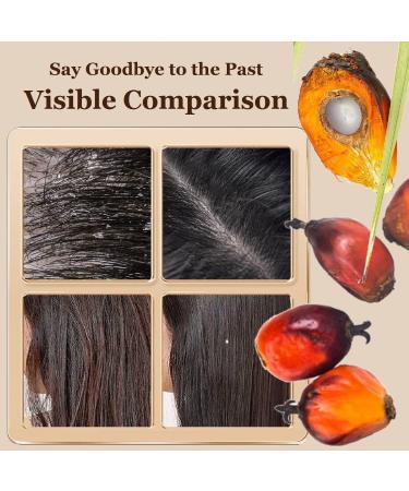 Batana Oil For Hair Growth Raw Batana Oil Batana Oil Organic for Hair and Scalp Pure Natural Batana Oil For Healthy Hair Hair Butter with Raw Batana Oil Promotes Hair Strength (1PC) - Buy Online on GoSupps.com