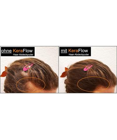 KeraFlow Root Powder - Hair Concealer & Thickener for Grey Hair | 4g Dark Brown - Best Solution for Thinning Hair - Buy Online on GoSupps.com
