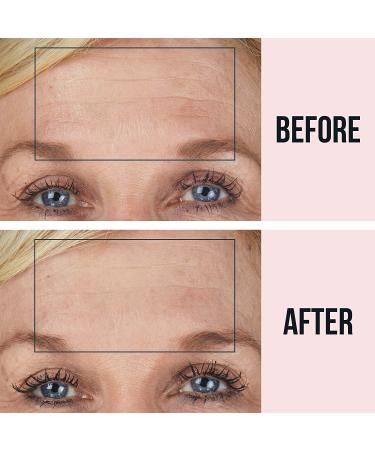 SiO Beauty BrowLift Anti-Wrinkle Forehead Patch - Reusable Silicone for Furrows & Expression Lines (Beige) - Buy Online on GoSupps.com