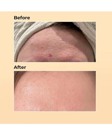 GoldSnailRX Snail Mucin Serum - 96% Korean Hydrating Facial Essence for Dry Skin & Wrinkle Repair | Luxury Skincare - Buy Online on GoSupps.com