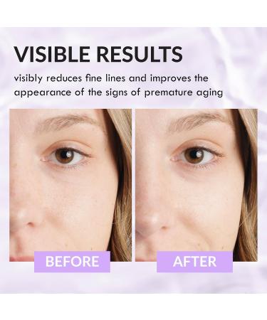 Wake Skincare Face Cream for Dry Skin Moisturiser for Dry Skin - Hyaluronic Acid Moisturiser - 50ml Dry Skin Cream - Natural Antioxidants & Dry Skin Face Cream Face Moisturiser for Dry Skin - Buy Online on GoSupps.com