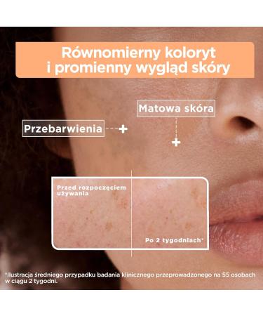 Mixa Anti-pigmentation face serum vitamin CG + glycolic acid - Buy Online on GoSupps.com