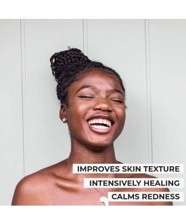 O Naturals Organic African Black Soap Bar 3PC - Shea Butter Enriched - Acne Prone Skin Solution - Natural Body & Face Wash - For Women & Men - 4 Ounce - Buy Online on GoSupps.com