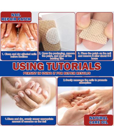 TaimeiMao 60 pieces nail digging repair patches 15 ml nail soft foot nails split nail repair strengthening nails nail digging repair patches for damaged nails and the appearance of - Buy Online on GoSupps.com