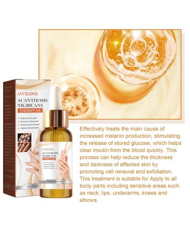 Fulvtuy JAYSUING Acanthosis Nigricans Therapy Oil - Reduces Dark Spots, Soothes Skin - 5 Pack - Buy Online on GoSupps.com