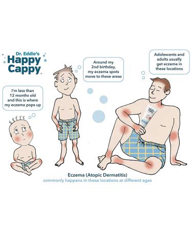 Happy Cappy Shampoo Bundle for Cradle Cap, Dandruff, Seborrheic Dermatitis, Eczema Prone Skin - Buy Online on GoSupps.com
