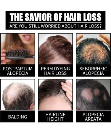  KOAHDE KOAHDE Hair Growth Liquid Hair Regrowth Treatments Fast Hair Growth Serum Serum for Hair Growth - Buy Online on GoSupps.com