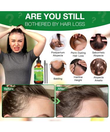 Chimoo 100% Natural Rosemary Oil for Hair - 60ml Hair Growth & Aromatherapy Essential Oil for Men & Women - Buy Online on GoSupps.com