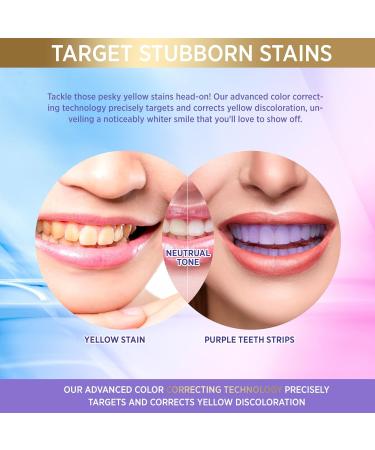 Purple Teeth Whitening Strips Color Correcting + Pap + Essential Oils Triple Action Powerful Formula Teeth Whitening Peroxide Free Sensitive Friendly Teeth Whitening Kit 28 Strips - Buy Online on GoSupps.com