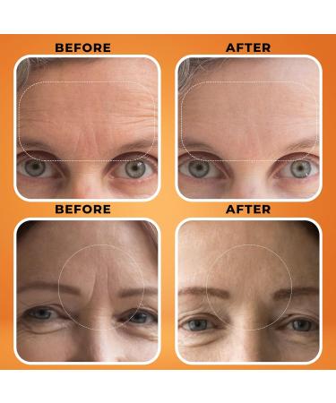 Botanifique Deep Wrinkle Filler for Face Collagen-Infused Cream with Birch Tree Sap Jojoba & Avocado Targets Fine Lines & Wrinkles Suitable for All Skin Types 1.3 fl oz - Buy Online on GoSupps.com