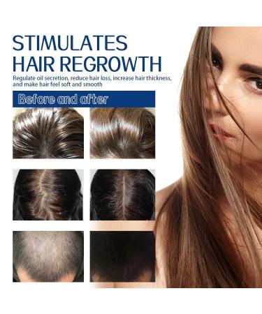 100g Hair Scrub for Scalp Exfoliating Hair Mask with Salicylic Acid & Sea Salt to Reduce Hair Loss Remove Buildup Soothe Itchy Scalp and Promote Thicker Healthier Hair Growth - Buy Online on GoSupps.com