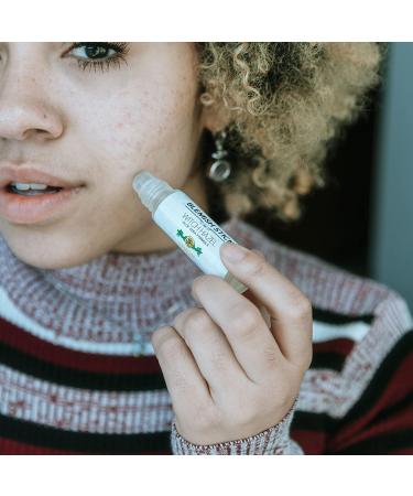 THAYERS Lemon Oil Control Blemish Stick - 0.23 oz | Clear Skin Solution - Buy Online on GoSupps.com