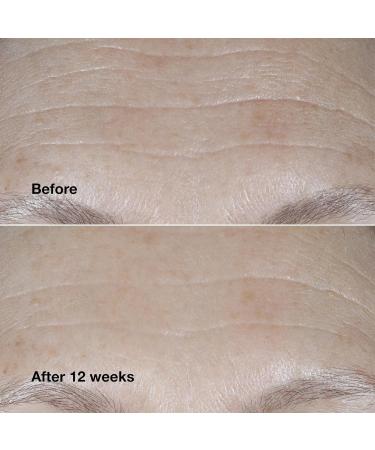 Smart Clinical Repair SPF 30 Wrinkle Cream | Peptides Hyaluronic Acid & Glycerin | Anti-Aging Skincare | 1.69 Fl Oz - Buy Online on GoSupps.com