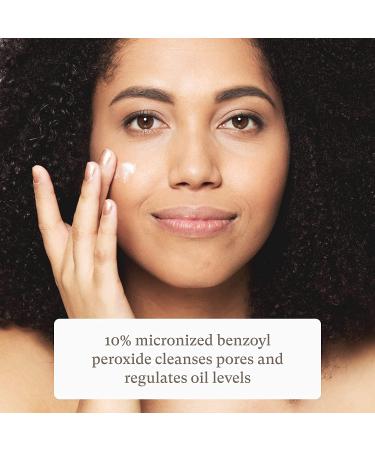 Botanic Tree Benzoyl Peroxide Acne Spot Treatment - Pimple Cream for Face and Skin Care - 2 oz (Pack of 1) - Buy Online on GoSupps.com