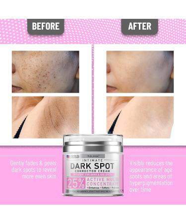 Melinda Dark Spot Corrector Cream for Sensitive Areas - 1.7 Oz - USA Made Arbutin Cream with Hyaluronic Acid & Aloe Vera - Underarm & Private Skin Lightening - Buy Online on GoSupps.com